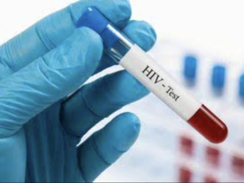 Tamaulipas sigue registrando contagios de VIH por falta de cultura preventiva