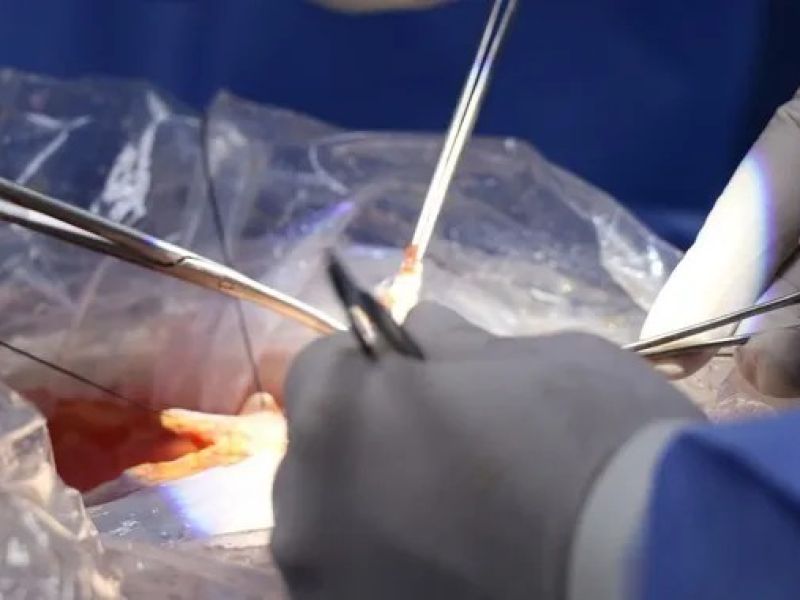 COEPRIS va contra charlatanes de la cirugía estética