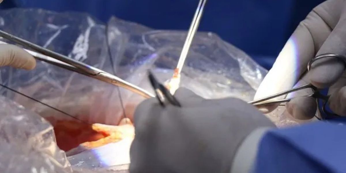 COEPRIS va contra charlatanes de la cirugía estética