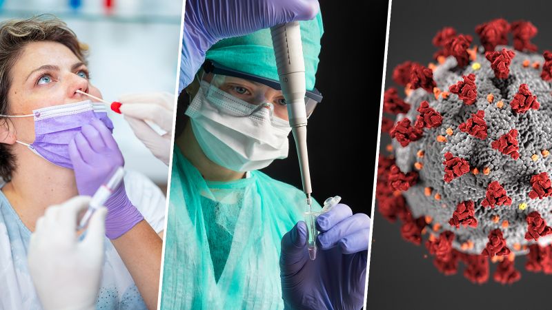 COVID-19 llega en 2025 con una nueva y más contagiosa variante: LP.8.1 Aquellos con enfermedades metabólicas podrían estar en mayor riesgo
