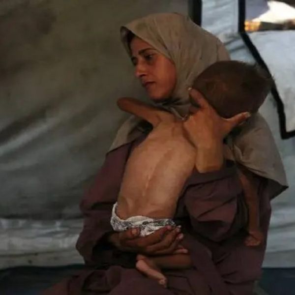 Mundo indiferente ante hambre y sufrimiento palestino en Gaza: ONU