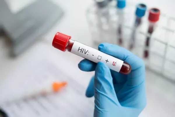 Descarta Salud brote de VIH en Tamaulipas