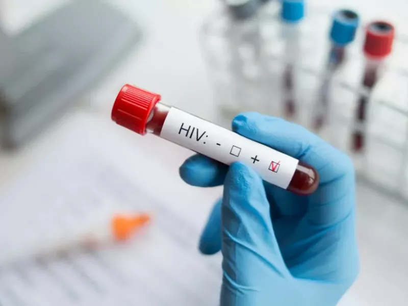 Descarta Salud brote de VIH en Tamaulipas