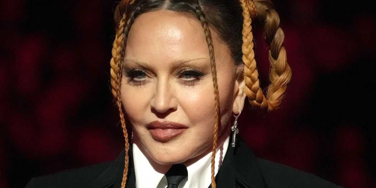 Madonna responde a las críticas y presume su cara ‘sin hinchazón’
