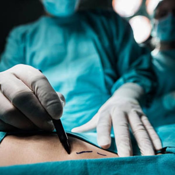 Cárcel a quien practique cirugía plástica en menores de edad