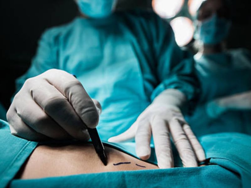 Cárcel a quien practique cirugía plástica en menores de edad