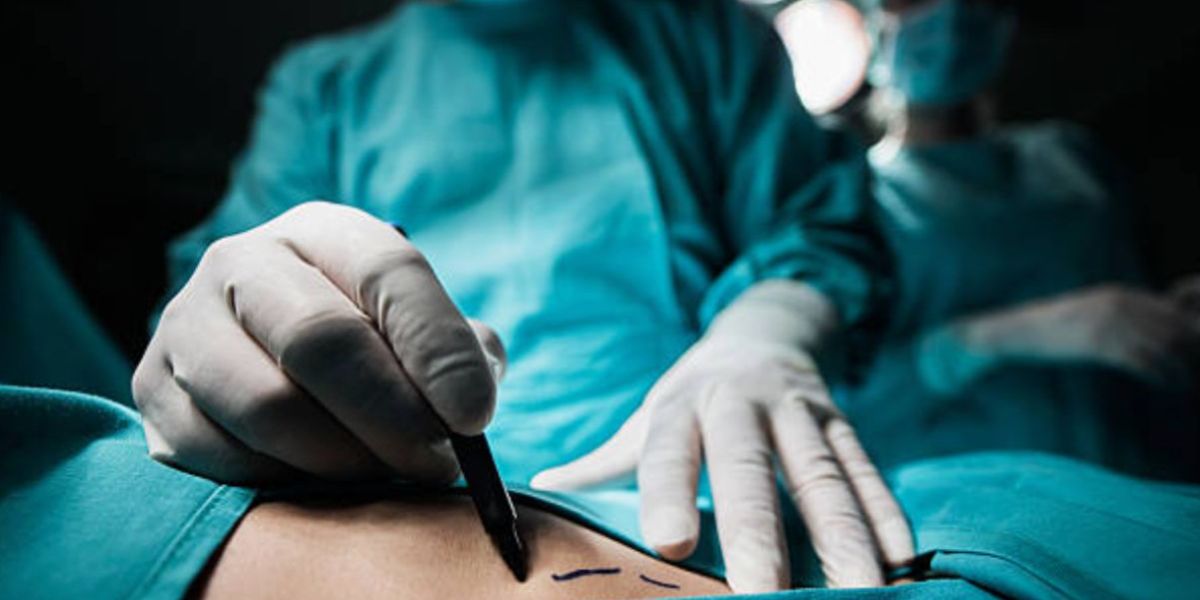 Cárcel a quien practique cirugía plástica en menores de edad