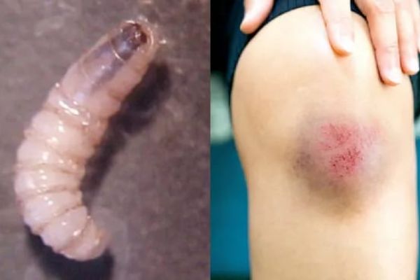 Descarta Salud casos de gusano barrenador en humanos en Tamaulipas