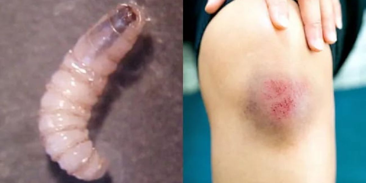 Descarta Salud casos de gusano barrenador en humanos en Tamaulipas